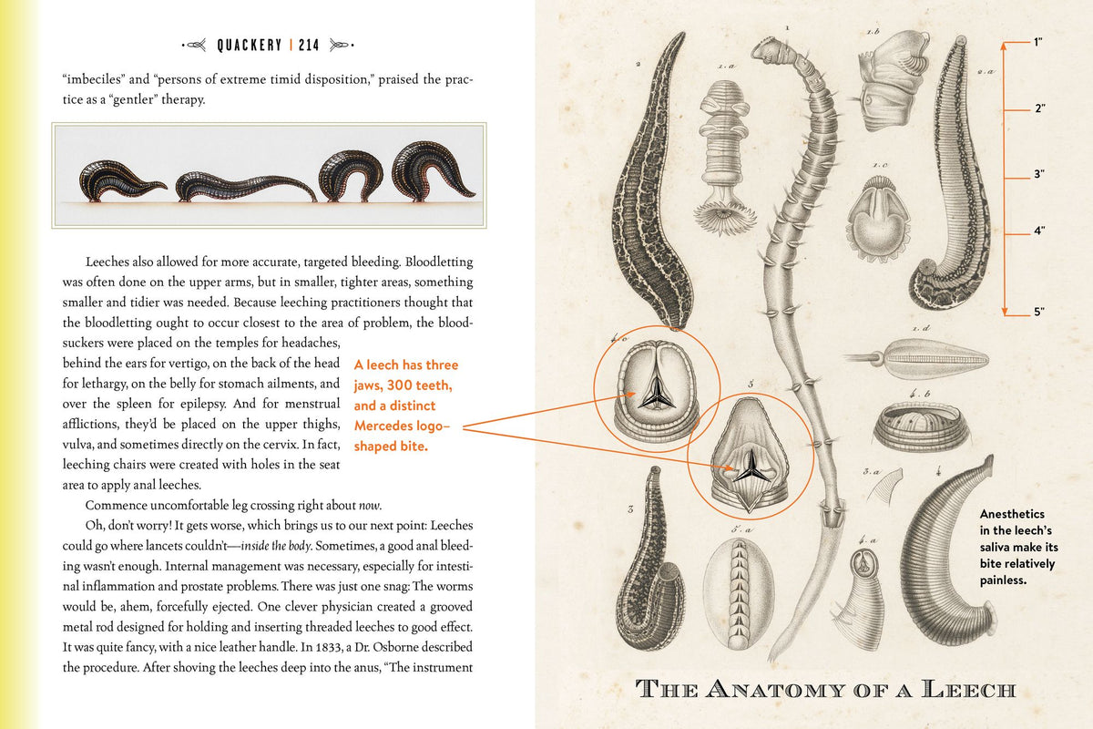 Quackery: A Brief History of the Worst Ways to Cure Everything