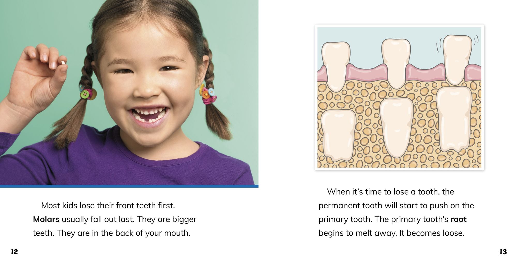 Losing a Tooth