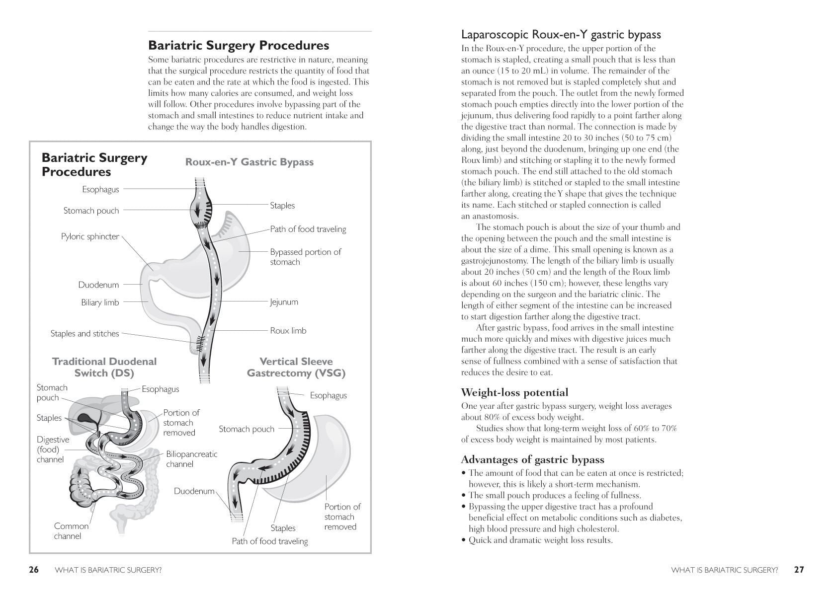 The Complete Bariatric Surgery Guide and Diet Program: Includes 150 Recipes for Lifelong Weight-Loss Success