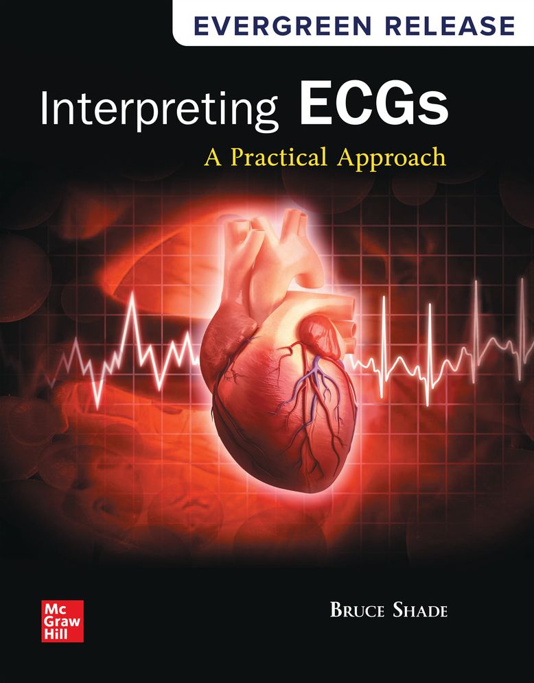 Interpreting ECGs: A Practical Approach
